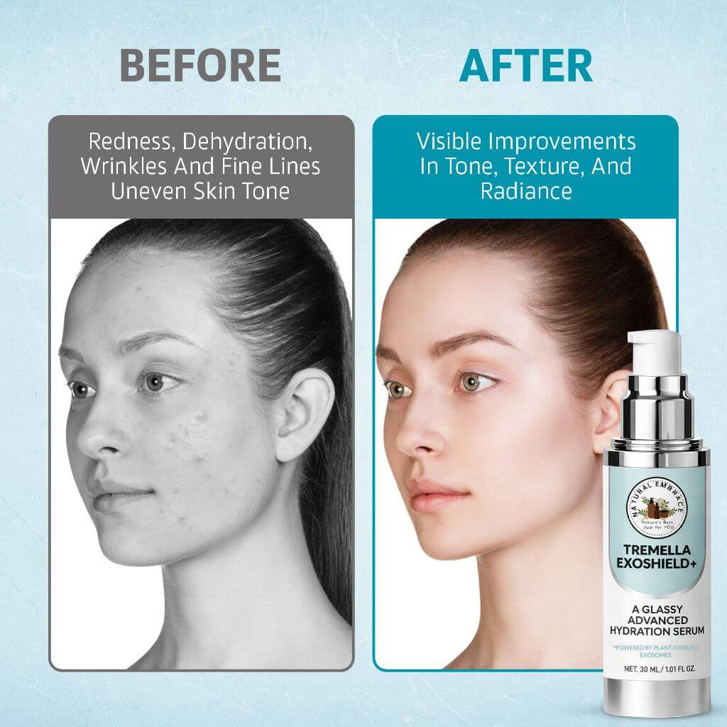 Tremella Mushroom Hydrating Serum bottle with yellow gel for glowing, hydrated skin and skin barrier support